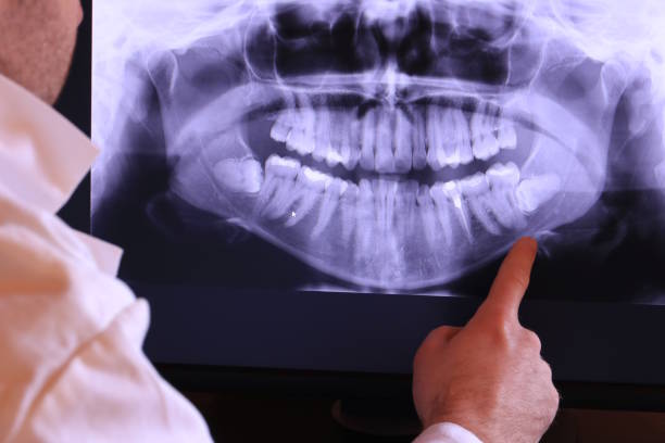 Best After-Hours Emergency Dentist in West University Place, TX