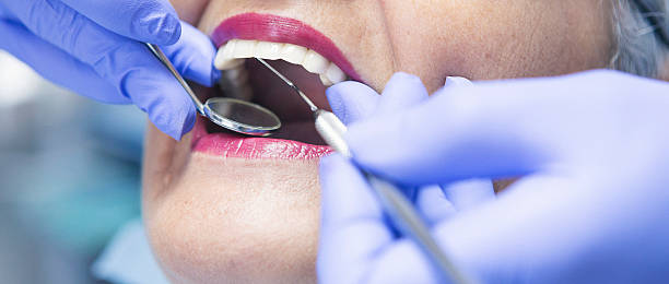 Best Emergency Treatment for Toothache in West University Place, TX