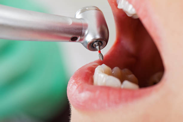 Best Walk-In Emergency Dentist in West University Place, TX